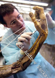 Anatomist disects plastinated hand
