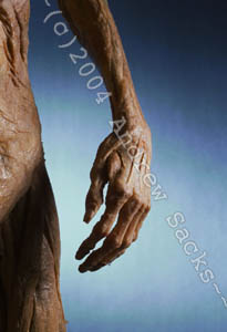 Plastinated hand and arm 
